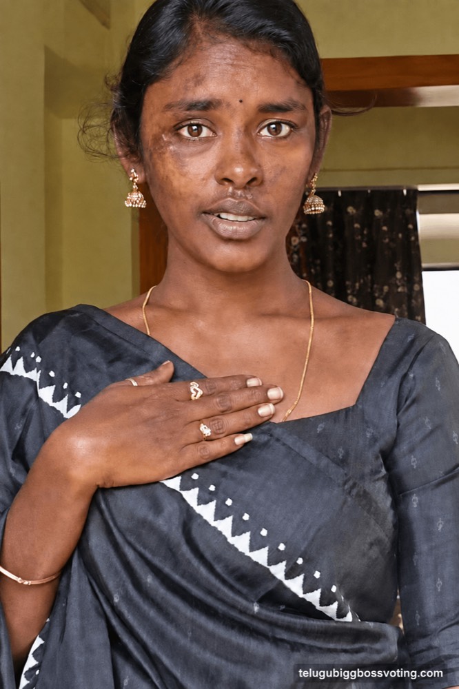Illustrated portrait of Rajakumari Dayana after her scooter accident, scars visible, hand on her heart